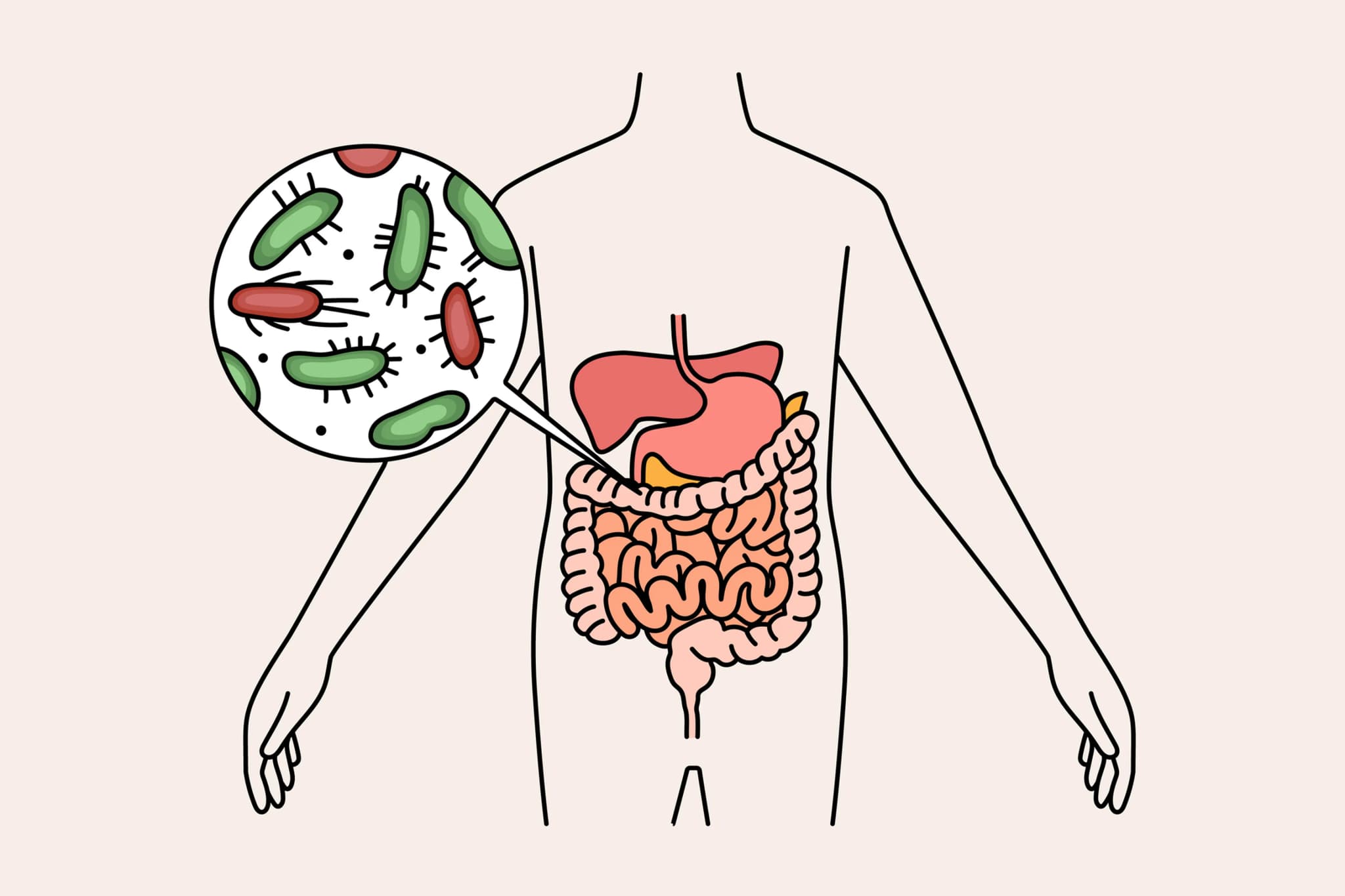 Tratamiento SIBO: Cómo Saber si Tienes Sobrecrecimiento Bacteriano